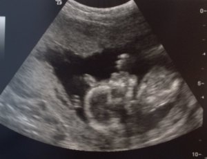 london ultrasound